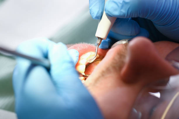 Best Teeth Whitening  in Rincon, GA