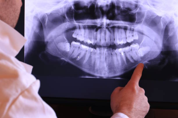 Best Tooth Pain Emergency Relief  in Rincon, GA