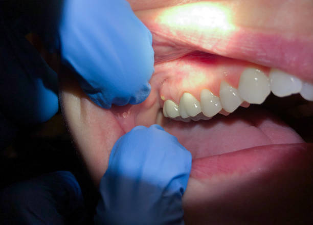 Best Dentist for Severe Toothache  in Rincon, GA